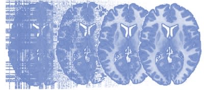 Principles of fMRI 2