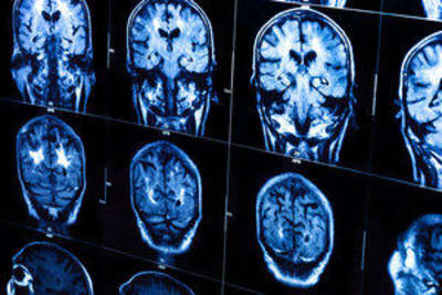 Good Brain, Bad Brain Program 